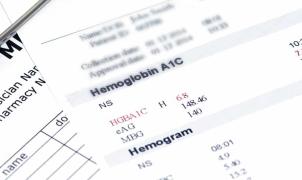 Primeiro plano de resultados de exames de laboratório mostrando os valores de hemoglobina glicada e hemograma numa folha.